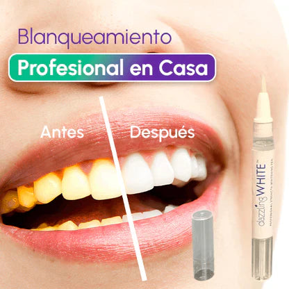 Lapiz Blanqueador Desmanchador De Dientes