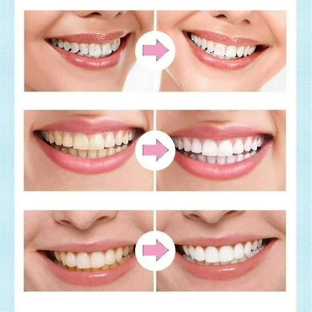Lapiz Blanqueador Desmanchador De Dientes