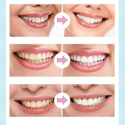 Lapiz Blanqueador Desmanchador De Dientes